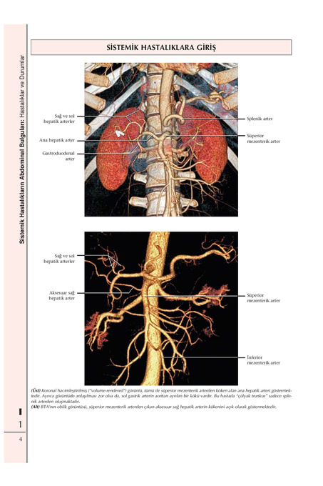 Diagnostic Imaging Abdomen Page 21