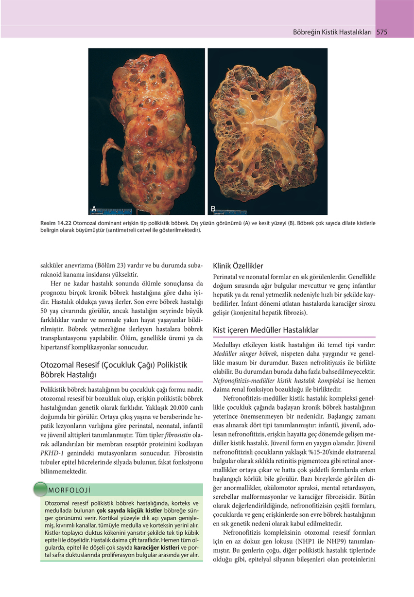 dolgu Evet Deniz mili  robbins patoloji atlası Page 52